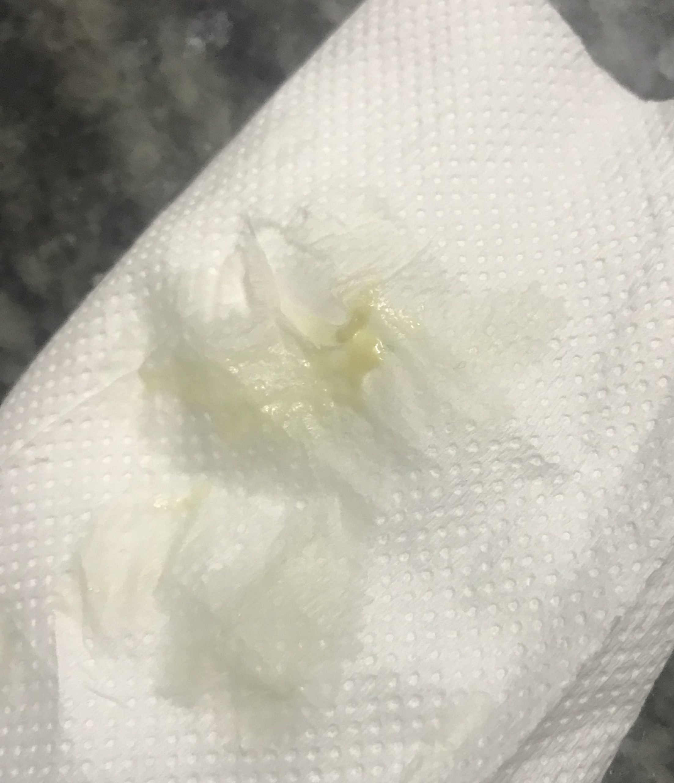 brown tinge in cervical mucus
